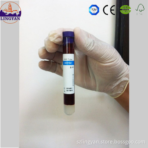facial use blood collecting tube PRP tube